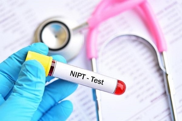 Xét nghiệm NIPT - Xét nghiệm sàng lọc trước sinh không xâm lấn