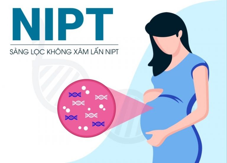 NIPT là xét nghiệm sàng lọc trước sinh giúp phát hiện dị tật thai nhi